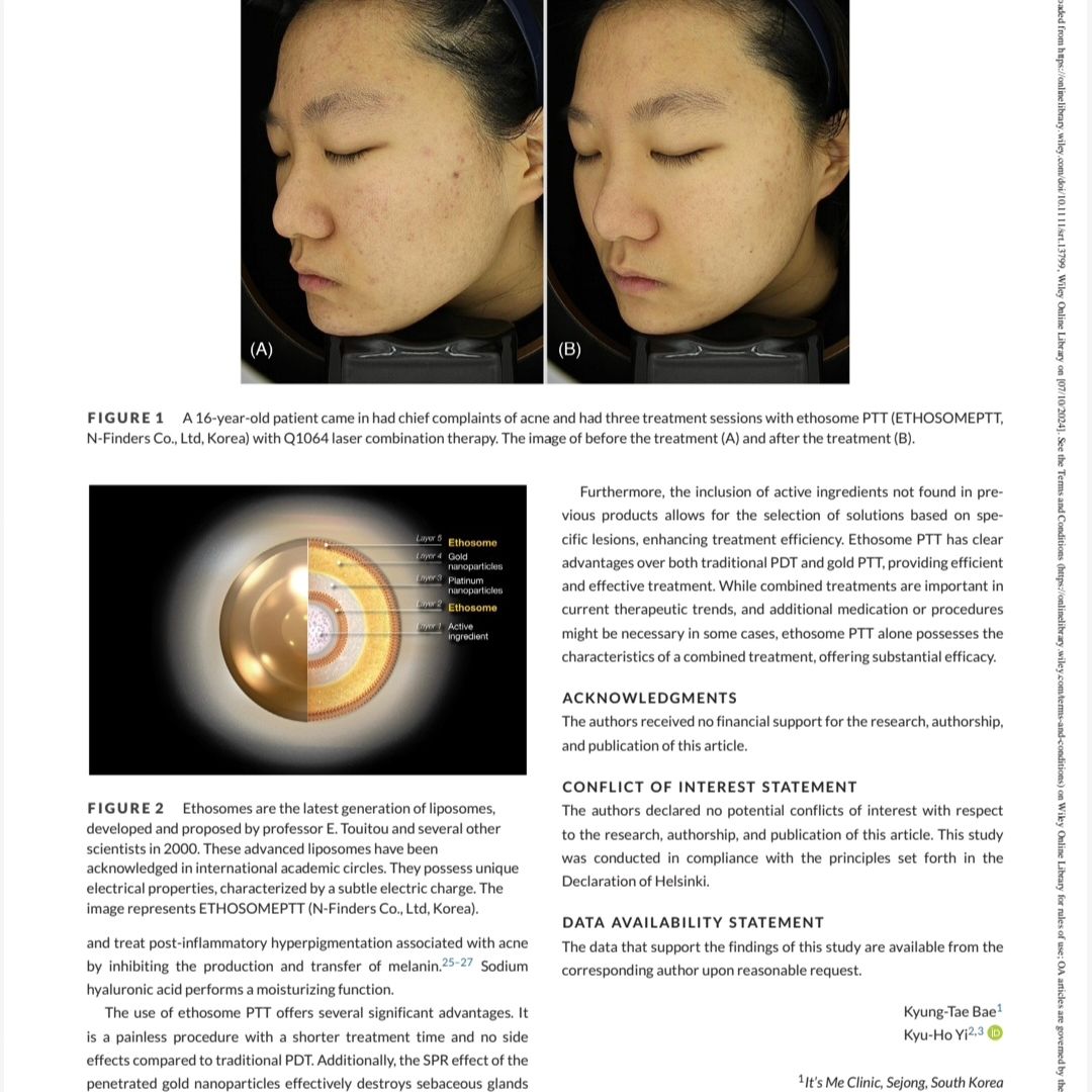 Ethosome Fototermal Tedavi (PTT) Nedir?