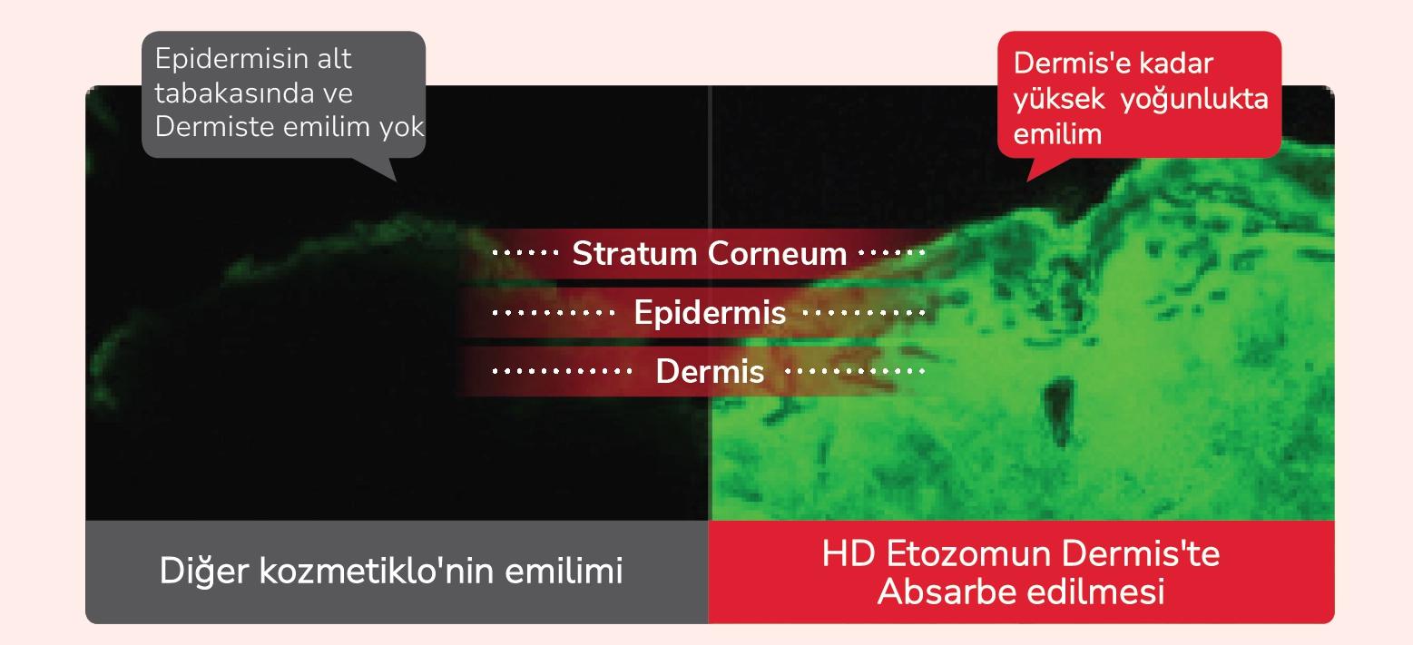 HD Ethosome Teknolojisi: İğnesiz Enjeksiyonun Geleceği