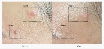 TC SPOT SOLUTION 32ml