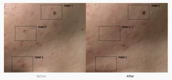 TC SPOT SOLUTION 32ml