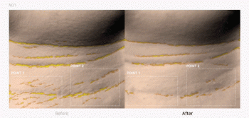 INTENSIVE NECK CARE KIT