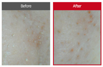 pH BALANCE PURE CLEANSING OIL 150ml