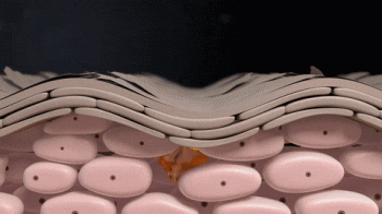 EXO LLT PRO AC FILLS SOLUTION 5ml×5ea