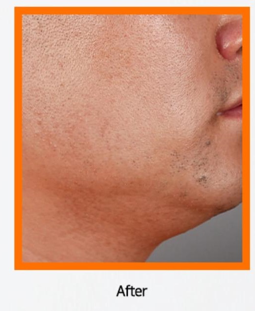 ETHOSOME DDS ASTAXANTHIN BOOSTER 5ml×5ea